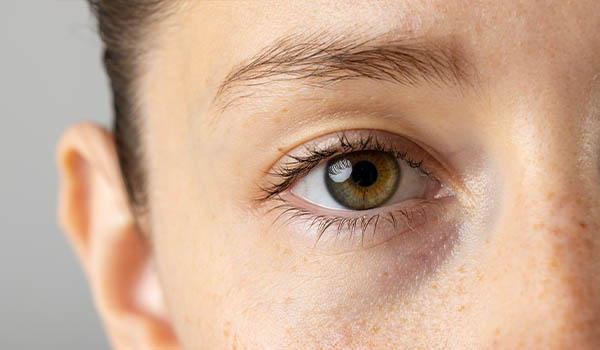 Ojo con nistagmo o movimiento involuntario de ojos