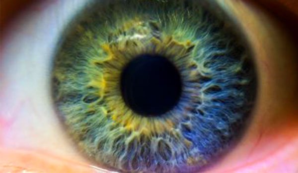 ojo con queratitis solar