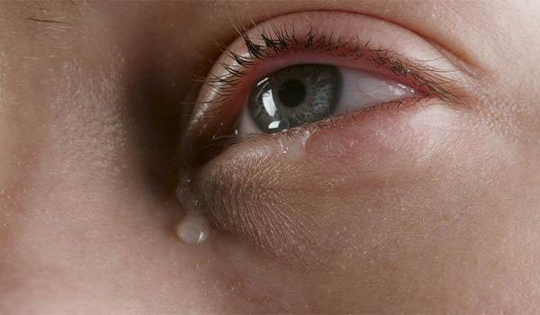 Ojos con ep&iacute;fora